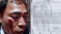 Ketua IWO I Sumsel Minta APH Segera Tindak Oknum RL atas Penganiayaan Wartawan Kipri Herdiansyah