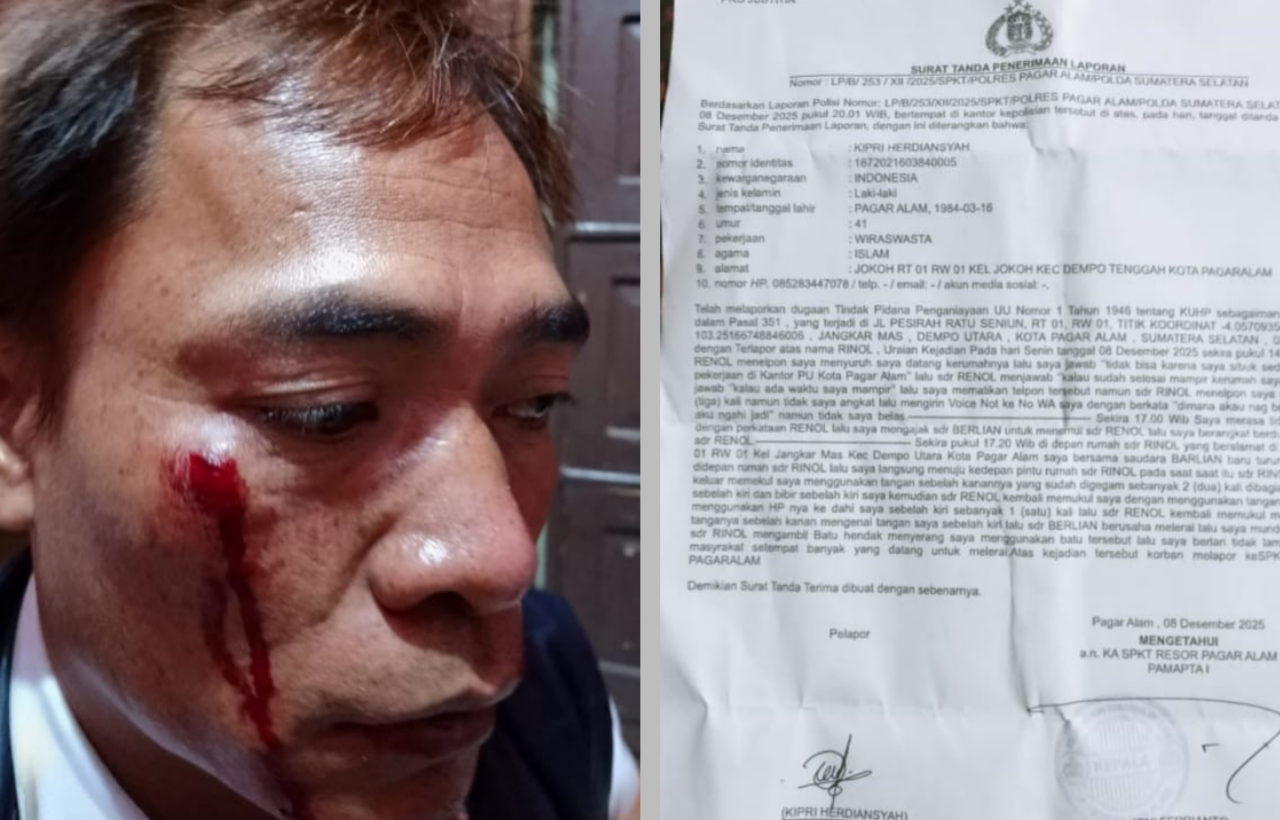 Ketua IWO I Sumsel Minta APH Segera Tindak Oknum RL atas Penganiayaan Wartawan Kipri Herdiansyah Ketua IWO I Sumsel Minta APH Segera Tindak Oknum RL atas Penganiayaan Wartawan Kipri Herdiansyah