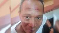 Nahas, Bermaksud Bantu Persoalan Kecelakaan, Pimpinan Redaksi BantenNet Malah Dianiaya Nahas, Bermaksud Bantu Persoalan Kecelakaan, Pimpinan Redaksi BantenNet Malah Dianiaya