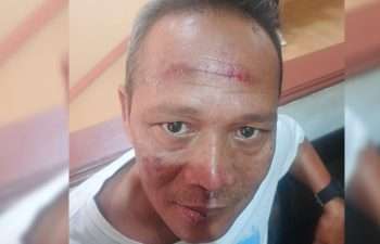 Nahas, Bermaksud Bantu Persoalan Kecelakaan, Pimpinan Redaksi BantenNet Malah Dianiaya