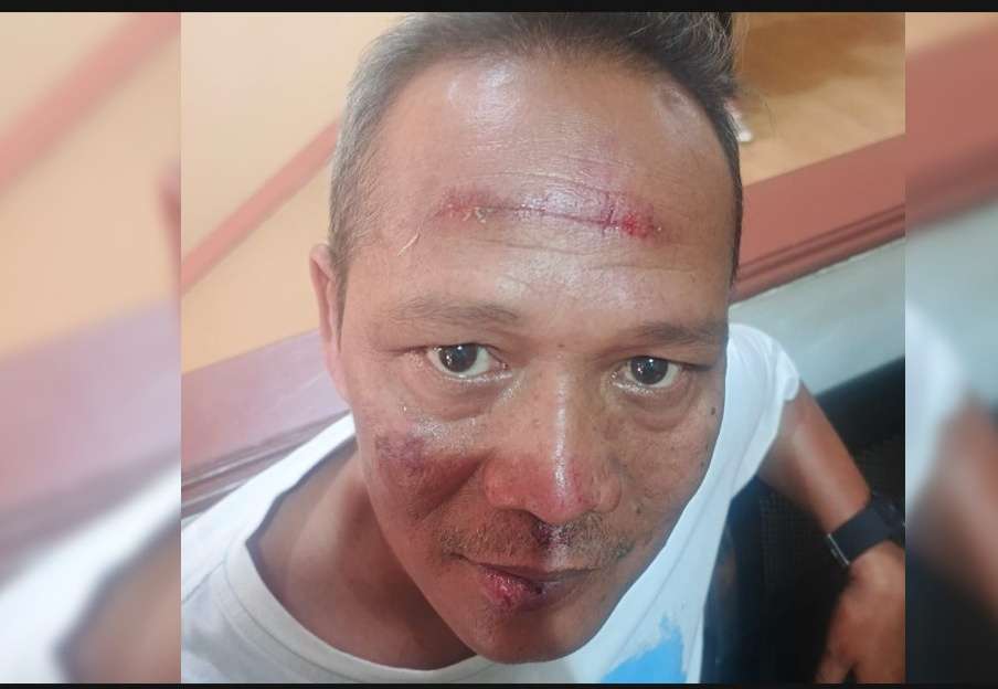Nahas, Bermaksud Bantu Persoalan Kecelakaan, Pimpinan Redaksi BantenNet Malah Dianiaya