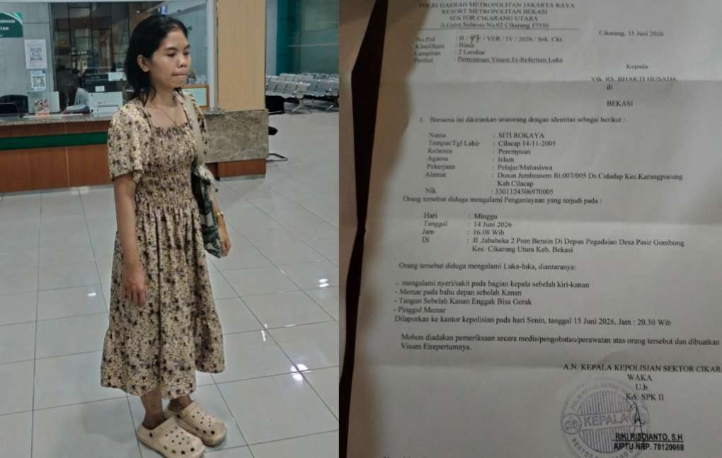 Diduga Jadi Korban Tabrak Lari, Karyawati PT Midea Lapor ke Polisi Diduga Jadi Korban Tabrak Lari, Karyawati PT Midea Lapor ke Polisi